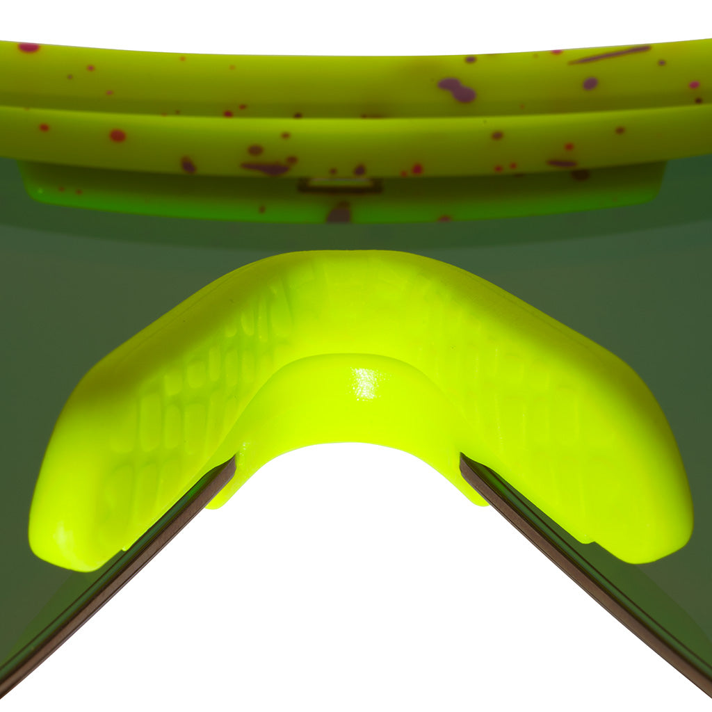 The 1993 Original 2.0 image 12